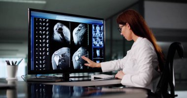 Kadın Nörolog Bilgisayar Ekranlarında Beyin MR Görüntülerini Analiz Ediyor