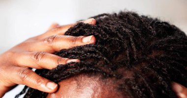 Profesyonel Dermatolog, Kuru Kaşıntılı Kafatası ile Afrikalı Kadın 'a Yardım Etti