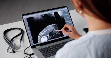 Ortopedi cerrahı radyoloji masasındaki MR 'ı inceledi. Hastanede röntgen teknisyeni omuz röntgeni analiz ediyor.