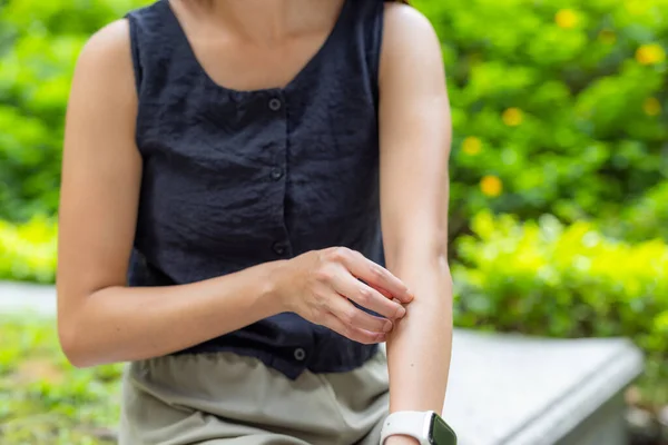 Woman Feeling Itchy Mosquito Bite Countryside Park — Stock Photo, Image