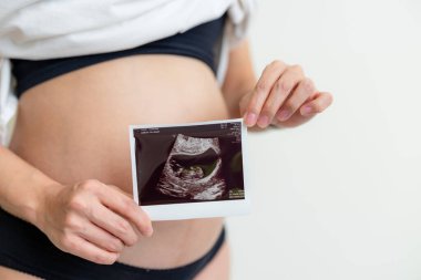 Ultrason karnı üzerinde tutan hamile kadın