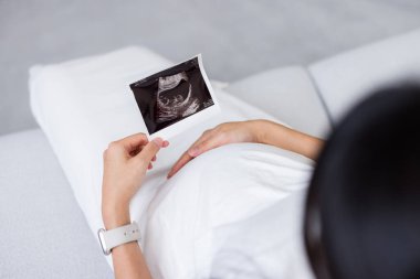 Hamile kadın ultrason fotoğrafıyla beklemede.