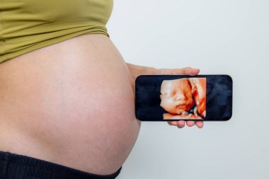 Hamile kadın cep telefonunda ultrason bebek fotoğrafı ile bekletiliyor.