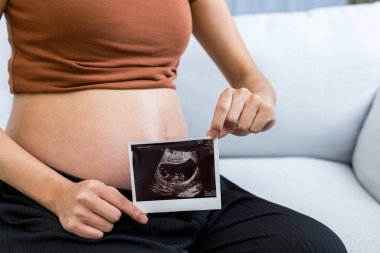 Evde çekilen ultrason bebek fotoğrafıyla hamile bırakılmış.