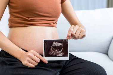 Ön tarafta Ultrason Görüntüsü Tutan Hamile Kadın