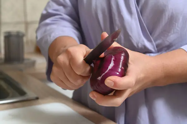 Woman Peels Red Onions Her Kitchen Female Hands Hold Salad Imagen de stock