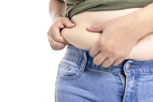 肥胖的女人 肥胖的女人 手拿着多余的腹部脂肪的女人 图库图片