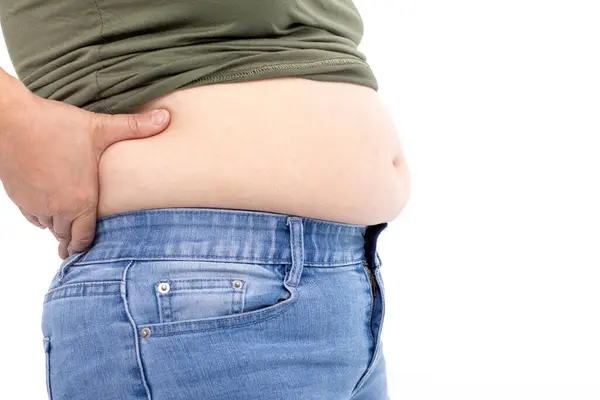 肥胖的女人 肥胖的女人 手拿着多余的腹部脂肪的女人 图库照片