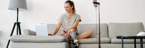 Smiling Young White Disabled Woman Blogger Prostetic Leg Sitting Sofa — Stok Foto