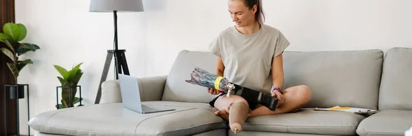 Hymyilevä Nuori Valkoinen Vammainen Nainen Proteettinen Jalka Istuu Sohvalla Kannettavan — kuvapankkivalokuva