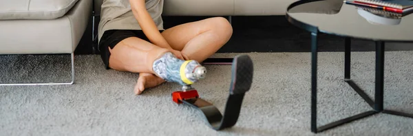 Młoda Biała Niepełnosprawna Kobieta Protetyczną Nogą Siedząca Podłodze Laptopem Domu — Zdjęcie stockowe