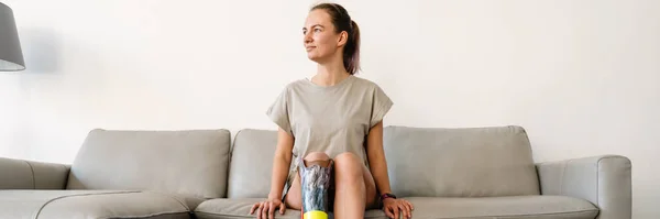 Leende Ung Vit Funktionshindrade Kvinna Med Prostetiskt Ben Sitter Soffa — Stockfoto