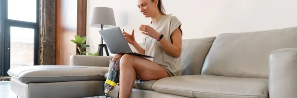 Nuori Valkoinen Nainen Jolla Proteesi Kannettavan Tietokoneen Avulla Istuessaan Sohvalla — kuvapankkivalokuva