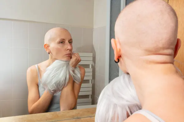 Mujer Triste Luchando Contra Cáncer Con Una Cabeza Afeitada Examina — Foto de Stock