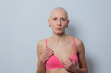 Ciddi bir ifadeyle mastektomiden sonra kel bir kız. Pembe spor sutyen giyiyor. Arkaplanda ameliyat izi var.