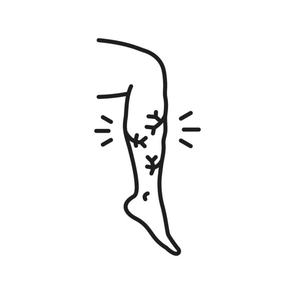 静脉曲张 腿上有血管网 病媒图标静脉水肿 低蛋白血症治疗疾病 性病腿肿胀线图标 — 图库矢量图片