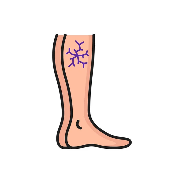 Варикозные Вены Нога Иконкой Контура Сосудистой Сети Векторная Боль Аномального — стоковый вектор