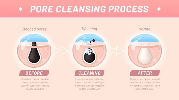Skin Cleaning Pore Cleansing Process Vector Step Step Infographics Involves — Stock Vector