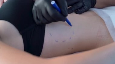 Doktor, kadının karnına kalemle çizgiler çiziyor. Siyah eldivenli estetik cerrah ameliyat için kadınların midesine çizim yapıyor. Zayıf kadınların sosyal baskısı. Yakın çekim