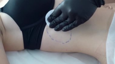 Kozmetik uzmanı bir kadının karnında ve belinde yağ yakmak için lipolitik enjeksiyon yapar. Dermatolog güzellik merkezinde yağları azaltma prosedürü uyguluyor. Kadın estetik kozmetolojisi