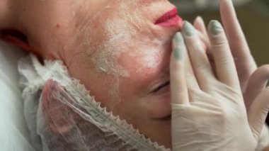 Kozmetik uzmanı, ultrason yüz temizleme ameliyatından önce kadın yüzünü yıkayıp temizliyor. Kozmetoloji prosedürleri. Yakın plan.