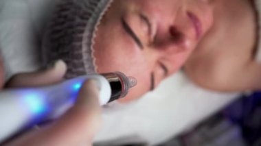 Estetik güzellik kliniğinde kozmetik uzmanı vakum makinesiyle kadın yüzü üzerinde hidrakiyal tedavi uyguluyor. Yakın plan.