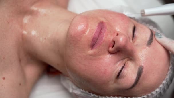 Kosmetologe Bei Einer Ultraschall Gesichtsreinigung Einer Kosmetologischen Klinik Schönheits Und — Stockvideo
