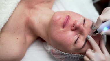 Güzellik kliniğinde kozmetik uzmanının kadın yüzü üzerinde hidrakiyal tedavi uyguladığı yakın çekim. Boşluğu kopyala