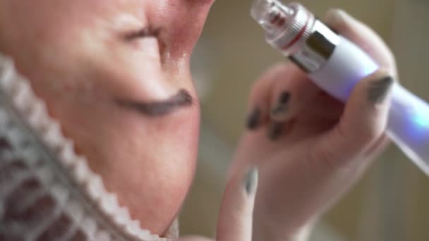 再生和水合 美容学概念 美容师使用水合物真空吸尘器在美容外科诊所做面部皮肤手术 后续行动 — 图库视频影像