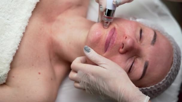 Der Kosmetologe Führt Hydrafaziale Eingriffe Durch Die Gesichtshaut Optimal Erhalten — Stockvideo