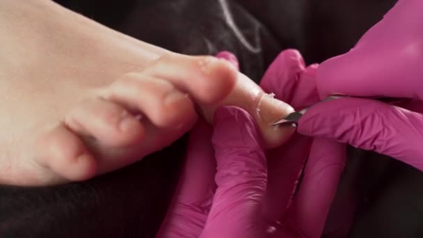 Terampil Ahli Penyakit Kaki Dalam Sarung Tangan Merah Muda Memotong — Stok Video
