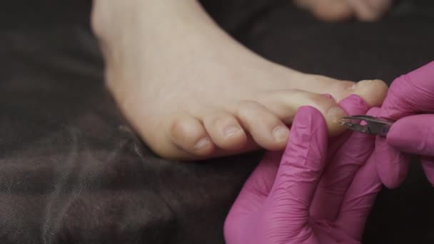 Chiropodist Κάνει Chiropody Και Κόβοντας Νύχια Των Ασθενών Εξειδικευμένο Ψαλίδι — Αρχείο Βίντεο