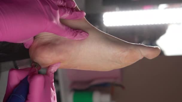 波德学家清除粗糙的皮肤 假肢大师在修脚 特写过程中 用研磨工具去除女性脚后跟上的干皮 垂直录像 — 图库视频影像