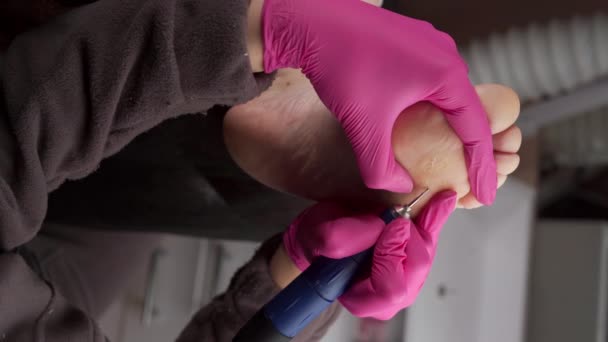 Pedicure Podolog Koncept Patient Medicinsk Hardware Pedicure Procedure Fodpleje Behandling – Stock-video