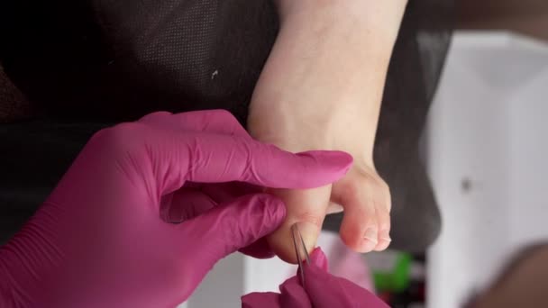 Pedicure Master Met Pincet Verwijderen Van Nagelriemen Van Teennagels Een — Stockvideo