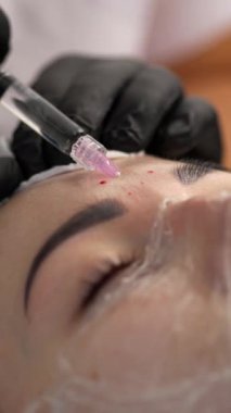 Kozmetik uzmanı, kadın yüzündeki kırışıklıkları düzeltmek için yüz enjeksiyonlarını yenileme prosedürü uyguluyor. Kozmetoloji konsepti. Yakın plan..