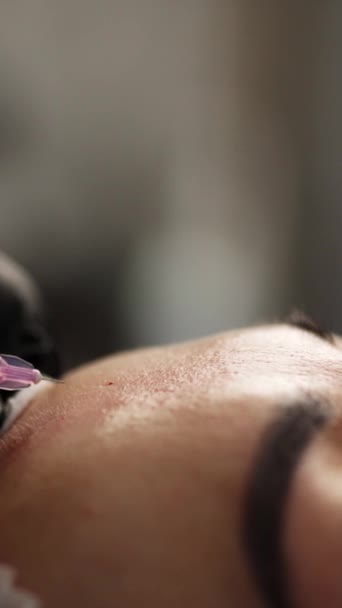 Kožní Estetické Zlepšení Léčby Dostat Bezpečné Vstřikování Čelo Mládeže Kosmetolog — Stock video