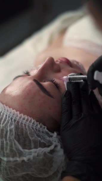 生物活性化とメセラピーのコンセプト 化粧品学者は 肌を若返らせるために化粧品の準備を顔の皮膚に注射する バーティカルビデオ クローズアップ — ストック動画
