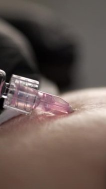 Kozmetik uzmanının yakın çekimi güzellik salonundaki yüz derisi üzerinde gençleştirici yüz enjeksiyonu prosedürünü yapar, makro çekim. Dikey video