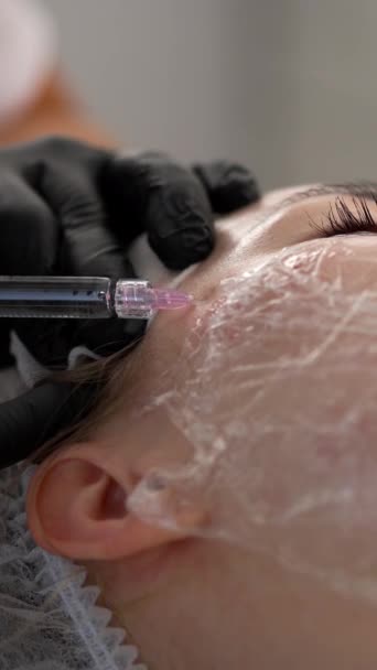 Primer Plano Mujer Está Recibiendo Inyecciones Faciales Rejuvenecedoras Esteticista Está — Vídeos de Stock