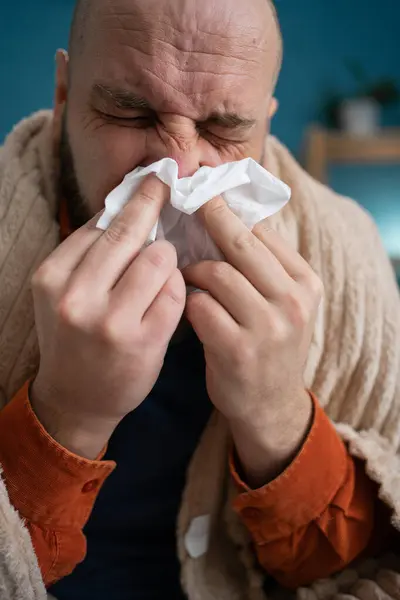 close-up of a man suffering from a runny nose sitting at home wiping his nose with a paper napkin. Cold and flu concept