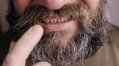 Kötü dişleri olan sakallı bıyıklı adam sigara içiyor. Diş problemi olanlar, yakın plan.