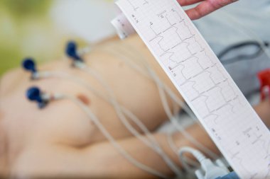 Elektrokardiyogram testine tabi tutulan ve göğsüne elektrotlar bağlanmış bir hasta, bir sağlık uzmanı olarak EKG ölçümlerini kontrol eder..