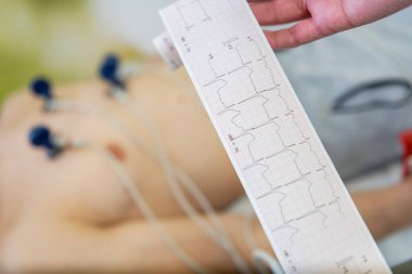 Elektrokardiyogram testine tabi tutulan ve göğsüne elektrotlar bağlanmış bir hasta, bir sağlık uzmanı olarak EKG ölçümlerini kontrol eder..
