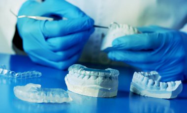 closeup of a dentist, wearing blue latex gloves, adjusting an occlusal splint, using a mouth cast clipart