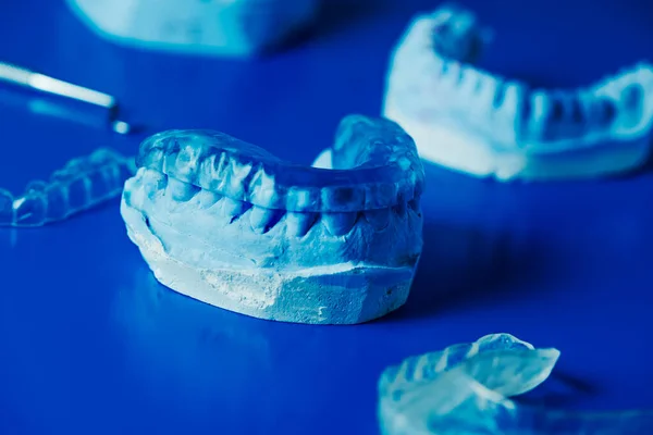 closeup of a occlusal splint in a dental mold on a blue surface next to some other dental molds and occlusal splints