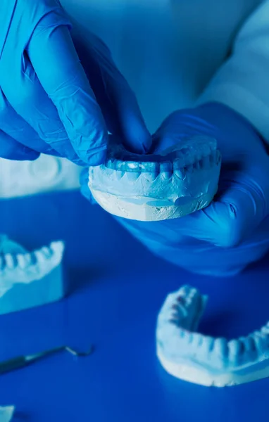Technik Modrých Latexových Rukavicích Testuje Zubní Plísni Modrou Okluzivní Dlahu — Stock fotografie