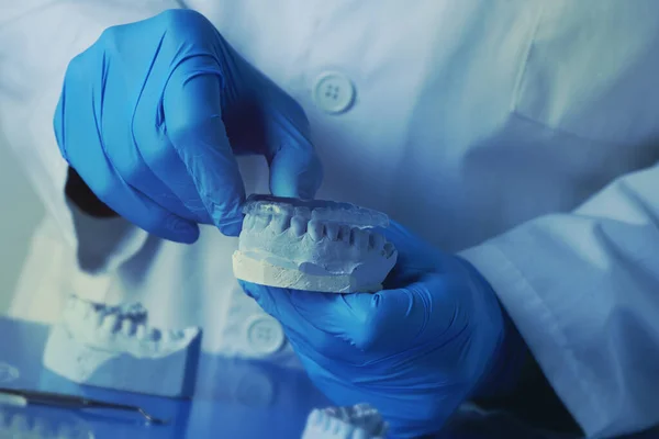 Closeup Dentist Wearing Blue Latex Gloves Testing Occlusal Splint Its — Stock Photo, Image