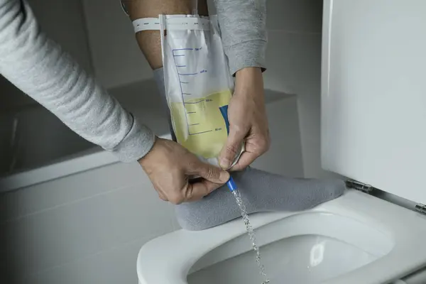 Ein Mann Freizeitkleidung Leert Seinen Urinableitbaren Beinbeutel Die Toilette Stockbild