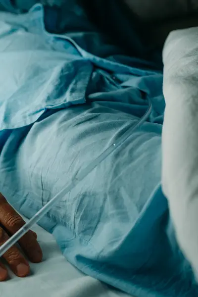 stock image a man, in a blue pajamas, wears a urinary catheterization lying face up in bed